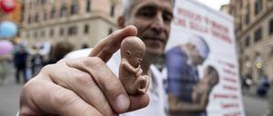 Schwangerschaftsabbrüche werden in den USA zunehmend kriminalisiert.