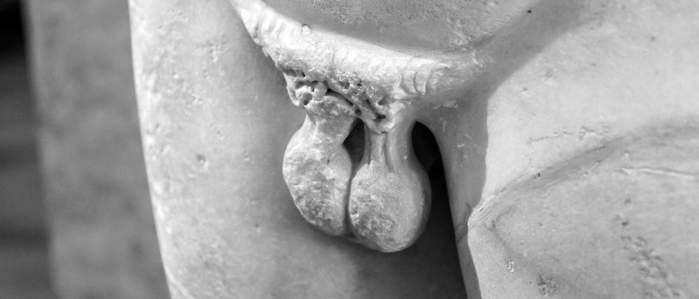 Der Penisbruch kann entstehen, wenn der erigierte Penis einer starken Biege- oder Drehkraft ausgesetzt wird.