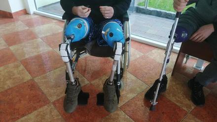 Hilfe vom Projekt „Prothesen für die Ukraine“: Patienten in Lwiw mit gespendeten Prothesen.