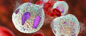 Computersimulation der Behandlung einer akuten lymphatischen Leukämie