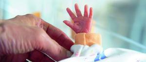 Im Jahr 2023 kamen in Deutschland mehr als 50.000 Kinder vor der 37. Schwangerschaftswoche zur Welt.