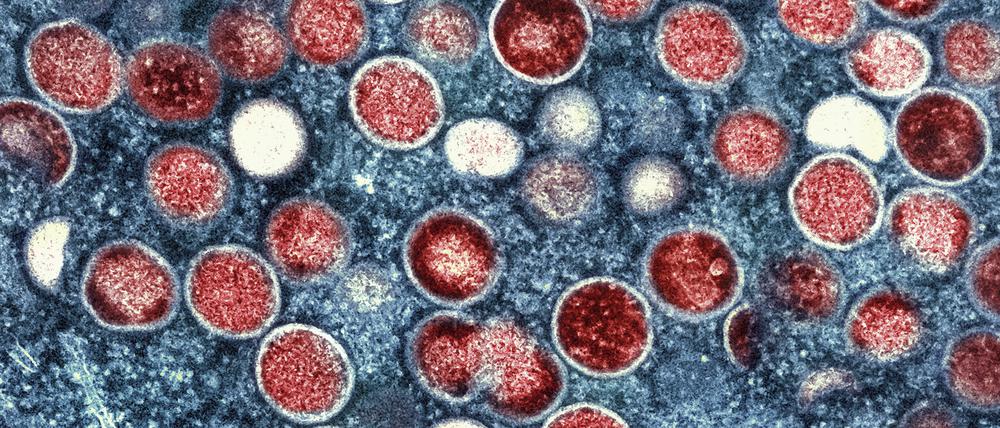 Eine Mikroskopaufnahme von Mpox-Partikeln (rot) in einer infizierten Zelle (blau), die im Labor kultiviert wurde. 