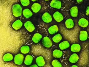 Eine kolorierte transmissionselektronenmikroskopische Aufnahme von Partikeln des Affenpockenvirus (grün), kultiviert und gereinigt aus einer Zellkultur, aufgenommen in der NIAID Integrated Research Facility, veröffentlicht am 26. Juli 2022 in Fort Detrick, Maryland. 