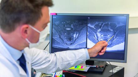 Rheumatologe Denis Poddubnyy zeigt anhand eines MRT-Bildes die in der Wirbelsäule betroffenen Stellen