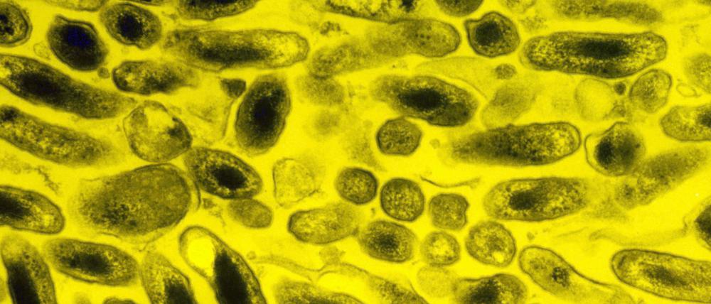 Das Bakterium Coxiella burnetti vermehrt sich gern im Inneren von Plazentazellen (hier gelb gefärbt), weshalb eine Infektion vor allem das Ungeborene gefährdet.