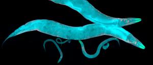 Caenorhabditis elegans, ein frei lebender, durchsichtiger Fadenwurm mit einer Länge von etwa 1 mm.