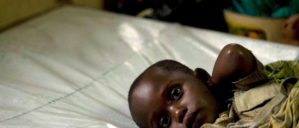 Epedemie Cholera Simbabwe ruft Notstand aus