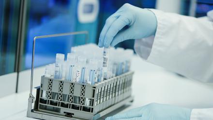 Ein Mitarbeiter hält in einem Coronatest-Labor PCR-Teströhrchen in den Händen. Eine neue Untervariante breitet sich aus.