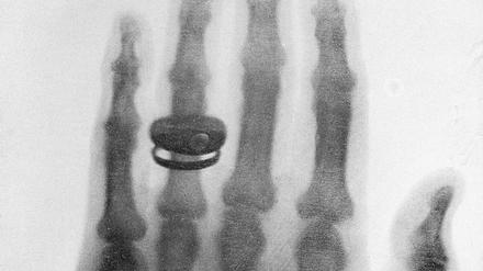 Wilhelm Konrad Röntgen bat im Dezember 1895 seine Frau Anna Bertha, ihre Hand als Testobjekt zur Verfügung zu stellen. Dabei entstand das erste dokumentierte „Röntgenbild“, das neben den Skelettknochen der Hand auch den Ehering zeigt. 