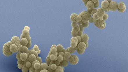 Eine um 15.000-mal vergrößerte Aufnahme des Bakteriums Mycoplasma mycoides.