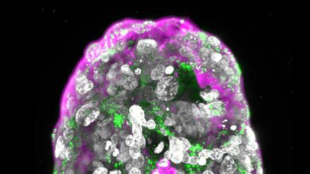 Im Labor gewachsen, aber vom menschlichen Original kaum zu unterscheiden: das „synthetische Embryomodell“ des Stammzellforschers Jacob Hanna.