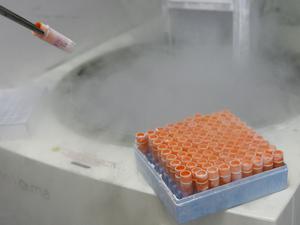 Tiefgefrorene embryonale Stammzellen. Archivbild von 2008.