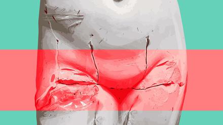 In Deutschland klafft eine große Versorgungslücke: Über das Thema Menstruationsbeschwerden wird im niedergelassenen Bereich kaum gesprochen. Dafür gibt es wirtschaftliche Gründe.