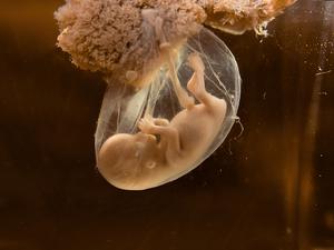 Menschlicher Embryo in Fruchtwasser-gefüllter Fruchtblase