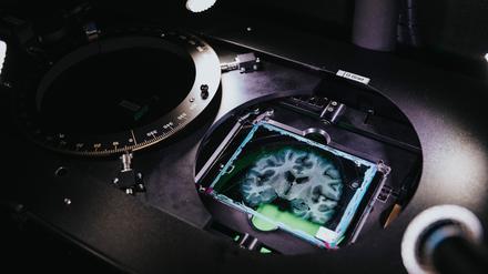 Menschlicher Hirnschnitt im Spezialmikroskop zur Darstellung von Nervenfasern.