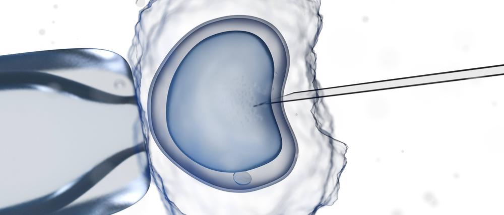 Wenn es auf natürlichem Weg nicht klappt, kann eine In-vitro-Fertilisation (IVF) einen  Kinderwunsch ermöglichen.