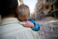 Ein verletztes syrisches Kind auf dem Arm eines Mannes in Damaskus