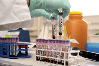 Laborant arbeitet mit Blutproben.