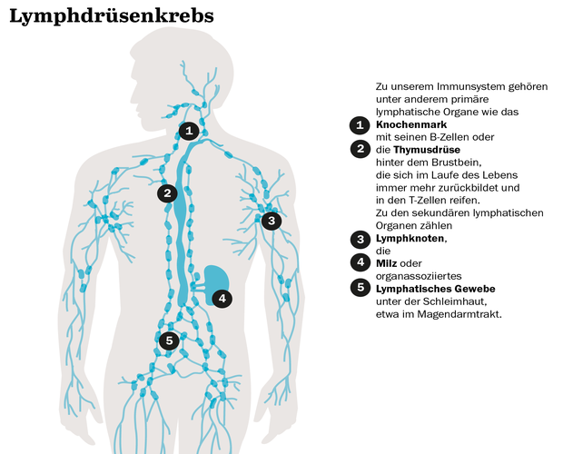 Von Antikörpern bis Stammzellspende Diese Therapieoptionen haben Patienten mit Lymphdrüsenkrebs