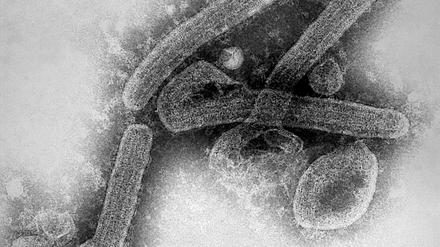 Das Elektronenmikroskop-Bild zeigt Marburg-Virus-Virionen. 