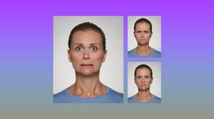 Botox kann Falten zeitlich begrenzt verschwinden lassen. Doch das Nervengift erschwert auch die nonverbale Kommunikation.