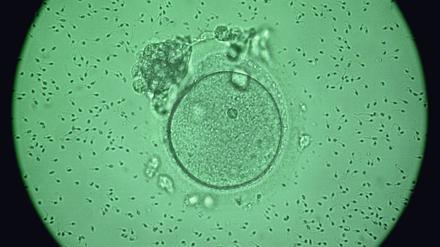 Die mikroskopische Aufnahme zeigt eine menschliche Eizelle, die von Spermien umgeben ist (Archivfoto vom 07.03.2001). Das Oberlandesgericht Hamm entscheidet am Mittwoch (06.02.2013), ob ein mit einer Samenspende gezeugtes Kind den Namen seines Vaters erfahren darf. Geklagt hat eine junge Frau, deren Mutter sich auf diese Weise anonym hatte befruchten lassen. Foto: Jan-Peter Kasper/dpa +++(c) dpa - Bildfunk+++