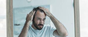 Unter Haarausfall leiden vor allem Männer – eine Haartransplantation schafft Abhilfe.