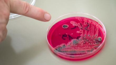 Salmonellen in einer Petri-Schale.