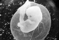 Ein sieben Wochen alter Fötus in einer Fruchtblase. In den ersten drei Monaten ist eine Abtreibung straffrei.