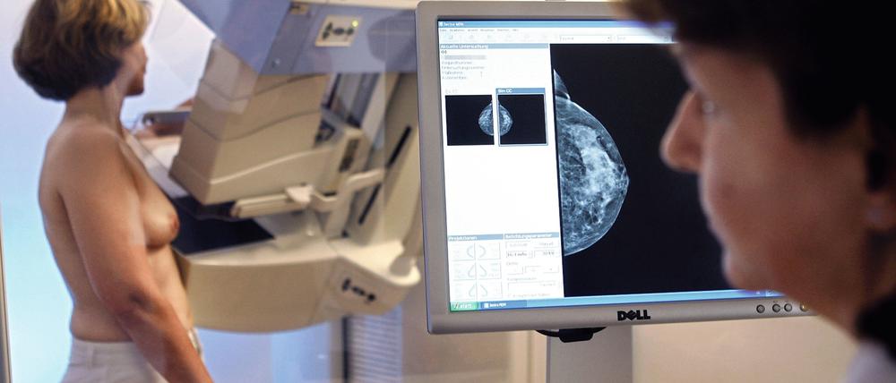 Bei Frauen zwischen 50 und 69 Jahren gilt die Mammographie als effektivste Methode zur Früherkennung von Brustkrebs.