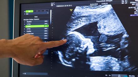 Ein Ultraschallbild in einer Frauenklinik. 