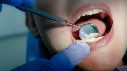 Regelmäßige Vorsorgeuntersuchungen werden allgemein empfohlen, die professionelle Zahnreinigung ist jedoch umstritten.