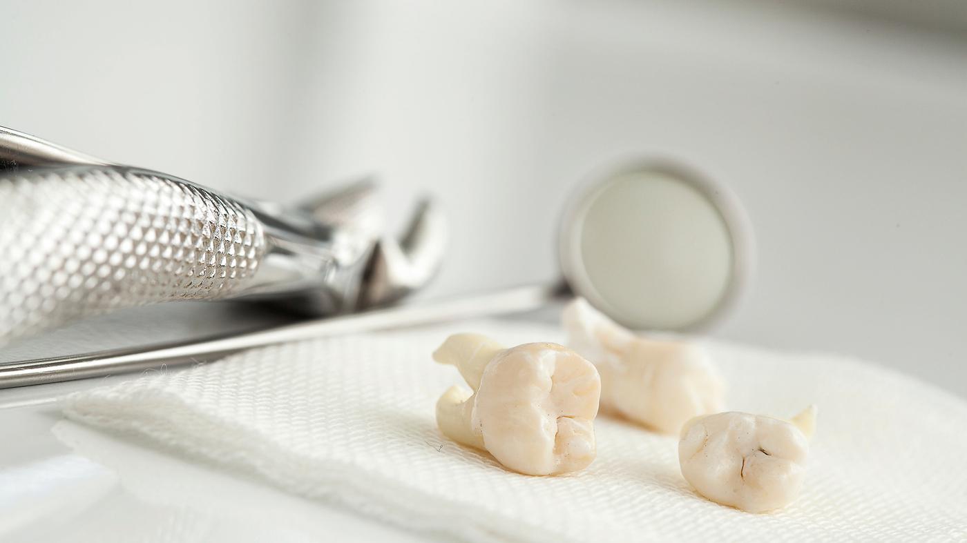 Un dentiste français aurait retiré plus de 3 000 dents saines