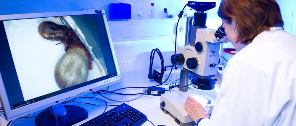 Eine medizinisch-technische Assistentin (MTA) betrachtet am 03.06.2013 in einem Labor der Parasitologie im niedersächsischen Gesundheitsamt in Hannover (Niedersachsen) zwei weibliche Zecken bei der Eiablage durch ein Mikroskop (links auf dem Monitor zu sehen).
