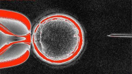 Erstmals ist es Forschern gelungen, menschliche Zellen in embryonale Stammzellen umzuwandeln. Wer am Dogma „menschliches Leben beginnt, wenn Ei und Samen miteinander verschmelzen“ festhält, sieht sich gezwungen, dem künstlich erzeugten Embryo die menschliche Würde abzusprechen.