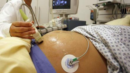 Nicht schädlich, aber auch ohne Nutzen: zusätzliche Ultraschalluntersuchungen von Schwangeren. 