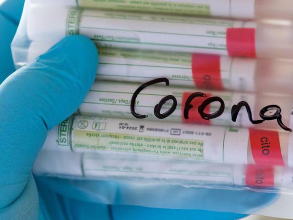 Fachleute diskutieren, ab wie vielen Neuansteckungen sollen welche Personen grundsätzlich auf Coronavirus getestet werden?