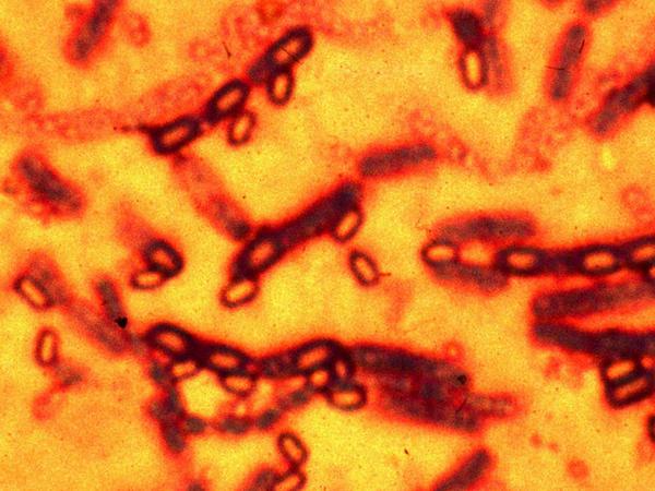 Tödlicher Organismus. Der den Milzbrand verursachende Bacillus anthracis unter dem Mikroskop.