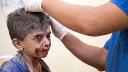 Erste Hilfe. Ein verletzter Junge wird in Aleppo medizinisch versorgt.