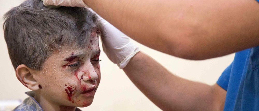 Erste Hilfe. Ein verletzter Junge wird in Aleppo medizinisch versorgt.