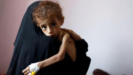 Dramatische Lage. Eine Jemenitin hält in einem Krankenhaus in der Hauptstadt Sanaa einen völlig unterernährten Jungen auf dem Arm.
