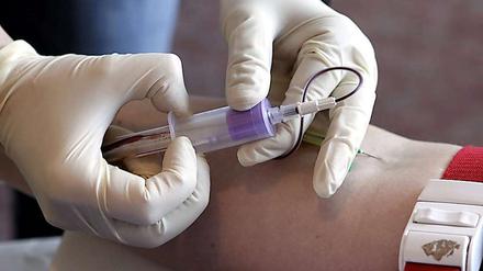 Sachsen-Anhalt will verpflichtende HIV-Tests für Risikogruppen einführen.