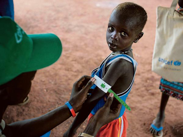 Vermessung des Hungers. Im Südsudan hat der Krieg verheerende Folgen für die Menschen.