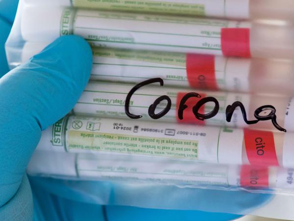 Proben für Coronatests 
