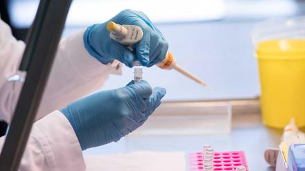 Eine Labormitarbeiterin bereitet eine DNA-Probe für die molekularbiologische Analyse vor.