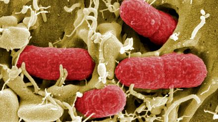 Coli-Bakterien sind oft besser als ihr Ruf. Im menschlichen Darm gibt es viele davon, und sie sind offenbar wichtige Trainingspartner für das frühkindliche Immunsystem 