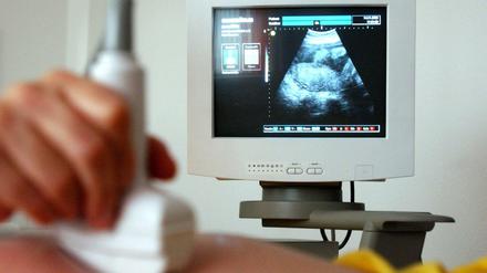 Ultraschalluntersuchung in der Schwangerschaft 