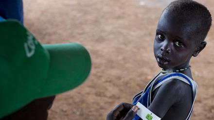 Hunger im Südsudan. Ein Mann misst den Armumfang eines Jungen in einer Nothilfeeinrichtung.
