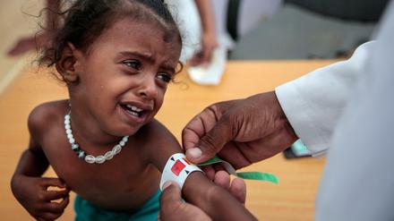 Unterernährt: Ein Arzt misst den Arm eines Mädchens in einem der wenigen noch funktionierenden Gesundheitszentren. V