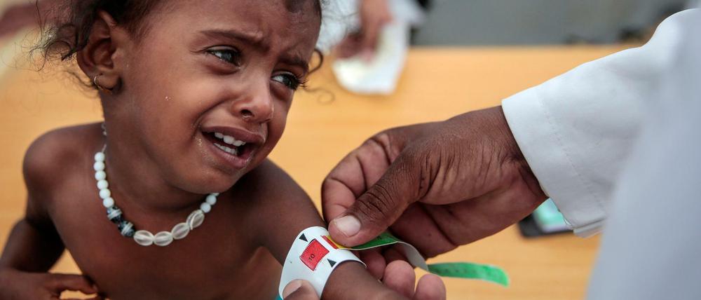 Unterernährt: Ein Arzt misst den Arm eines Mädchens in einem der wenigen noch funktionierenden Gesundheitszentren. V